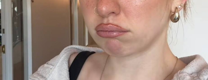 «Альфа-кашель» и «надутый утконос»: зумеры строят новые гримасы в погоне за трендом