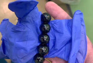 В Сургуте спасли двух детей, которые проглотили магнитики и батарейку