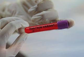 В Югре узнали о двух случаях заражения омикрон-штаммом коронавируса