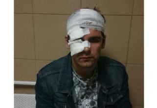 В Сургуте пьяный собачник избил известного уличного музыканта 